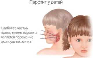 Вакцинация против паротита (свинка): сроки, особенности проведения и возможные побочные эффекты