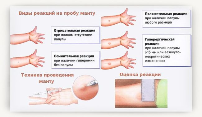 виды реакций